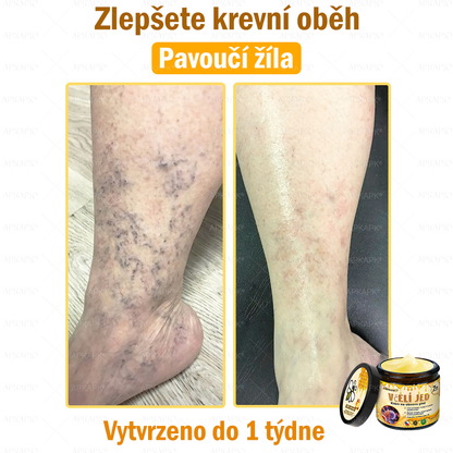 🐝🐝Dermatologicky a klinicky testováno👩‍⚕️DR.Fachmer®Bee Venom Krém na obnovení pleti🐝 pomáhá při léčbě kožních problémů, jako jsou: vrásky, jizvy, pigmentové skvrny, strie, akné, psoriáza, ekzém, kožní změny, podráždění, záněty a další kožní problémy.
