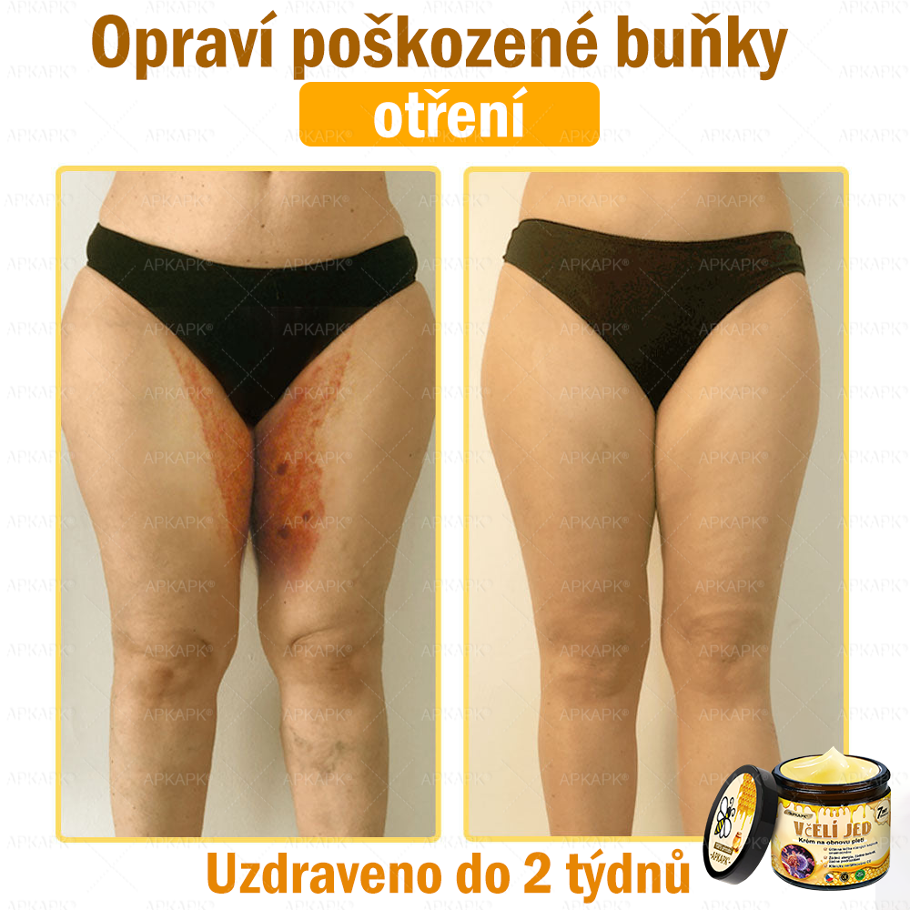 🐝🐝Dermatologicky a klinicky testováno👩‍⚕️DR.Fachmer®Bee Venom Krém na obnovení pleti🐝 pomáhá při léčbě kožních problémů, jako jsou: vrásky, jizvy, pigmentové skvrny, strie, akné, psoriáza, ekzém, kožní změny, podráždění, záněty a další kožní problémy.