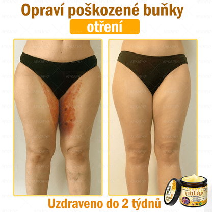 🐝🐝Dermatologicky a klinicky testováno👩‍⚕️DR.Fachmer®Bee Venom Krém na obnovení pleti🐝 pomáhá při léčbě kožních problémů, jako jsou: vrásky, jizvy, pigmentové skvrny, strie, akné, psoriáza, ekzém, kožní změny, podráždění, záněty a další kožní problémy.