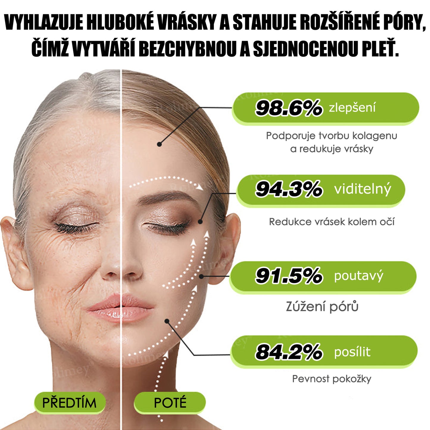 🔔Vyrobeno a odesláno z České republiky | Rolimey® Botox & Vita-A Retinol Shot Krém na vrásky a zpevnění pokožky – Poslední den akce 70% SLEVA