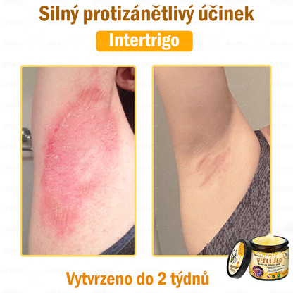 🐝🐝Dermatologicky a klinicky testováno👩‍⚕️DR.Fachmer®Bee Venom Krém na obnovení pleti🐝 pomáhá při léčbě kožních problémů, jako jsou: vrásky, jizvy, pigmentové skvrny, strie, akné, psoriáza, ekzém, kožní změny, podráždění, záněty a další kožní problémy.