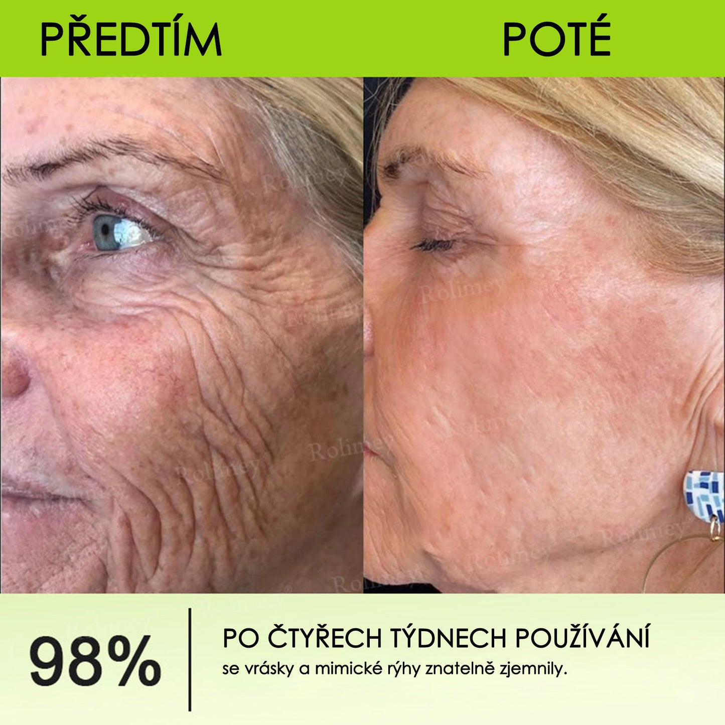 🔔Vyrobeno a odesláno z České republiky | Rolimey® Botox & Vita-A Retinol Shot Krém na vrásky a zpevnění pokožky – Poslední den akce 70% SLEVA