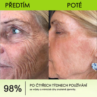 🔔Vyrobeno a odesláno z České republiky | Rolimey® Botox & Vita-A Retinol Shot Krém na vrásky a zpevnění pokožky – Poslední den akce 70% SLEVA