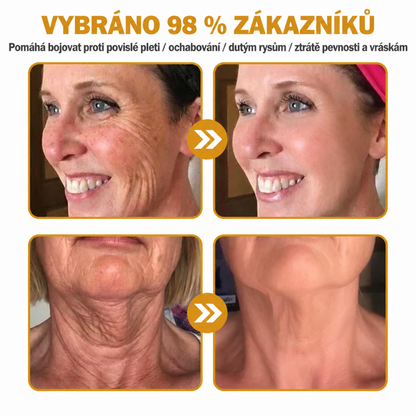 🌞Rolimey® Komplexní krém s včelím jedem Pro— Zpevňující péče pro všechny typy pokožky 🌞