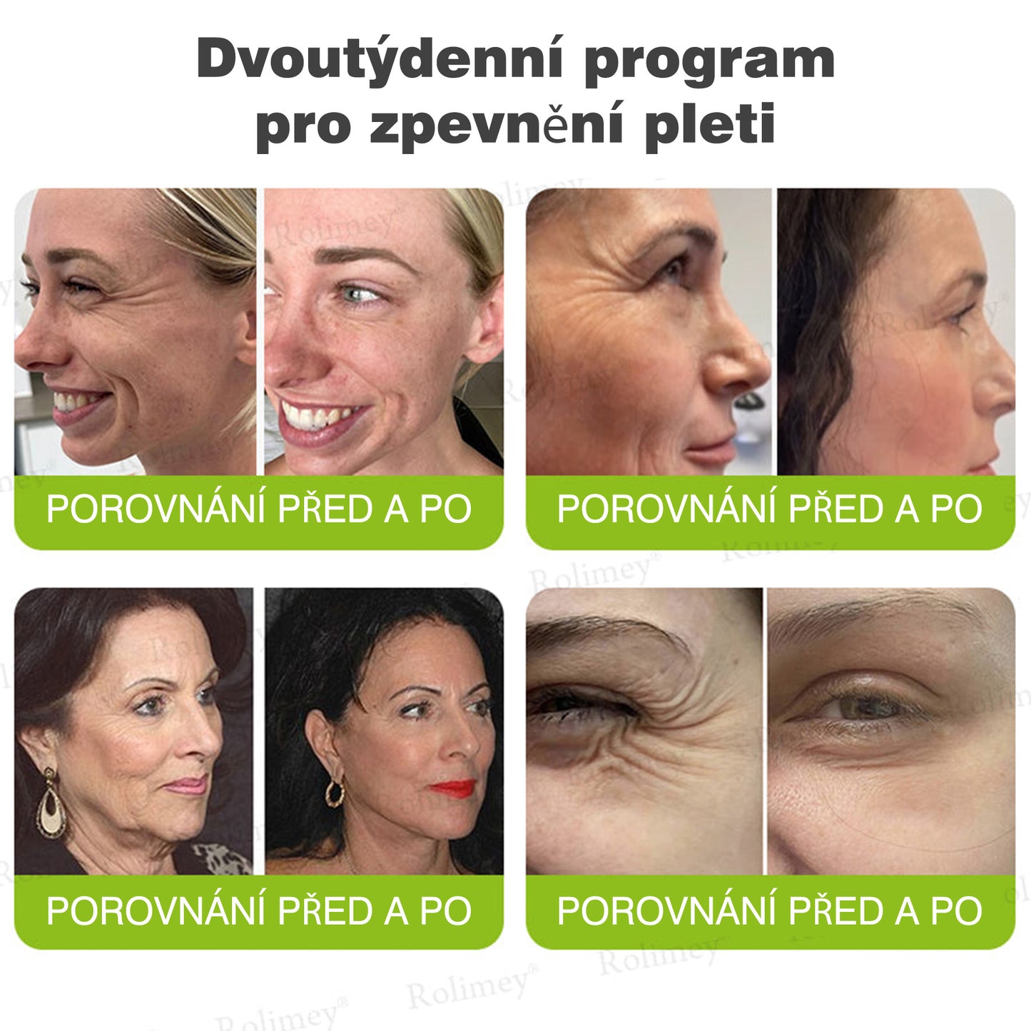 🔔Vyrobeno a odesláno z České republiky | Rolimey® Botox & Vita-A Retinol Shot Krém na vrásky a zpevnění pokožky – Poslední den akce 70% SLEVA