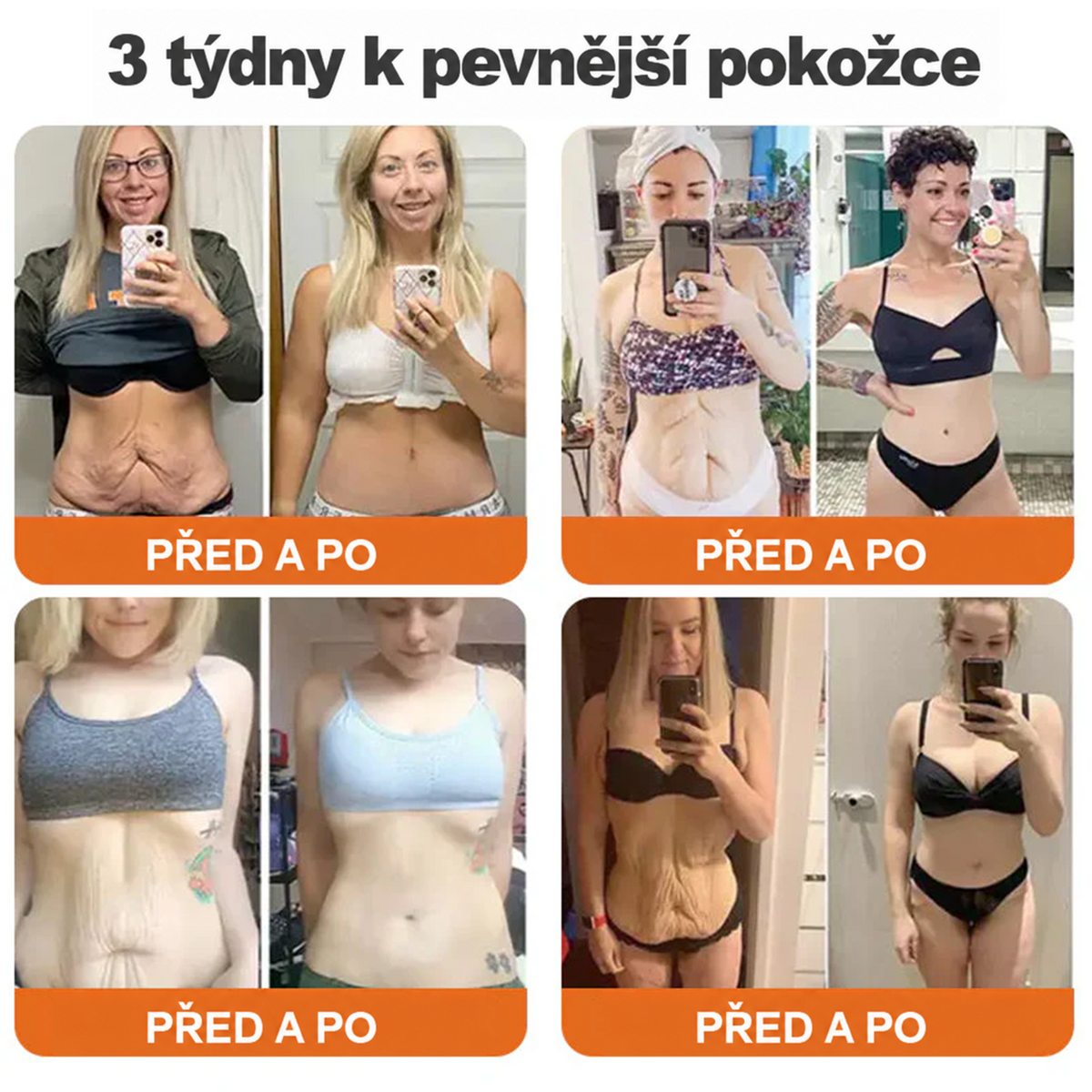 🌞Rolimey® Komplexní krém s včelím jedem Pro— Zpevňující péče pro všechny typy pokožky 🌞