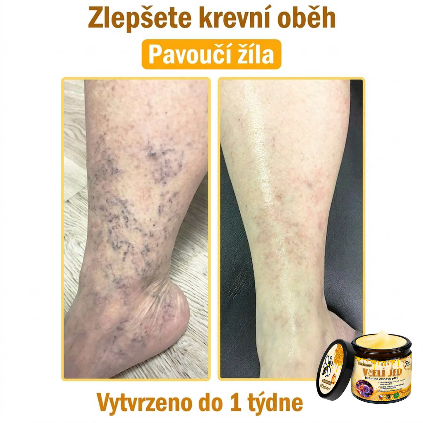 ⚡Dermatologicky a klinicky testováno👩‍⚕️DR.Fachmer®Bee Venom Krém na obnovení pleti🐝 pomáhá při léčbě kožních problémů, jako jsou: vrásky, jizvy, pigmentové skvrny, strie, akné, psoriáza, ekzém, kožní změny, podráždění, záněty a další kožní problémy.