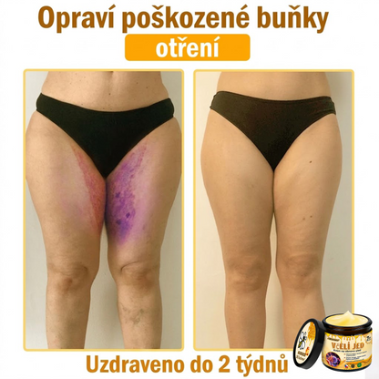 ⚡Dermatologicky a klinicky testováno👩‍⚕️DR.Fachmer®Bee Venom Krém na obnovení pleti🐝 pomáhá při léčbě kožních problémů, jako jsou: vrásky, jizvy, pigmentové skvrny, strie, akné, psoriáza, ekzém, kožní změny, podráždění, záněty a další kožní problémy.