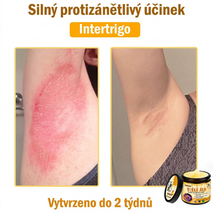⚡Dermatologicky a klinicky testováno👩‍⚕️DR.Fachmer®Bee Venom Krém na obnovení pleti🐝 pomáhá při léčbě kožních problémů, jako jsou: vrásky, jizvy, pigmentové skvrny, strie, akné, psoriáza, ekzém, kožní změny, podráždění, záněty a další kožní problémy.