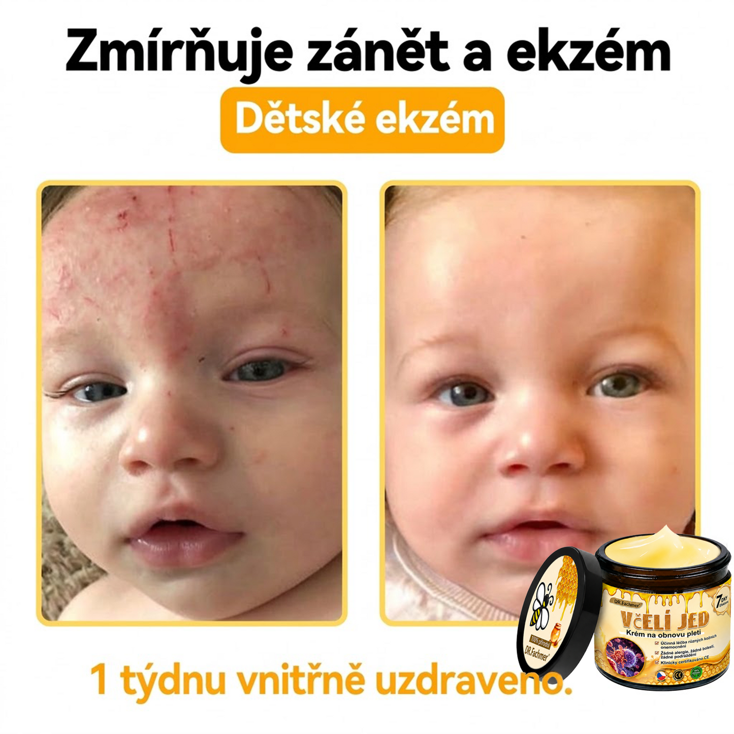 ⚡Dermatologicky a klinicky testováno👩‍⚕️DR.Fachmer®Bee Venom Krém na obnovení pleti🐝 pomáhá při léčbě kožních problémů, jako jsou: vrásky, jizvy, pigmentové skvrny, strie, akné, psoriáza, ekzém, kožní změny, podráždění, záněty a další kožní problémy.