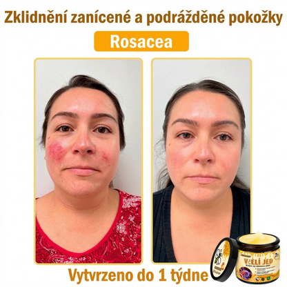 ⚡Dermatologicky a klinicky testováno👩‍⚕️DR.Fachmer®Bee Venom Krém na obnovení pleti🐝 pomáhá při léčbě kožních problémů, jako jsou: vrásky, jizvy, pigmentové skvrny, strie, akné, psoriáza, ekzém, kožní změny, podráždění, záněty a další kožní problémy.