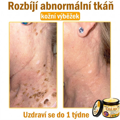 ⚡Dermatologicky a klinicky testováno👩‍⚕️DR.Fachmer®Bee Venom Krém na obnovení pleti🐝 pomáhá při léčbě kožních problémů, jako jsou: vrásky, jizvy, pigmentové skvrny, strie, akné, psoriáza, ekzém, kožní změny, podráždění, záněty a další kožní problémy.
