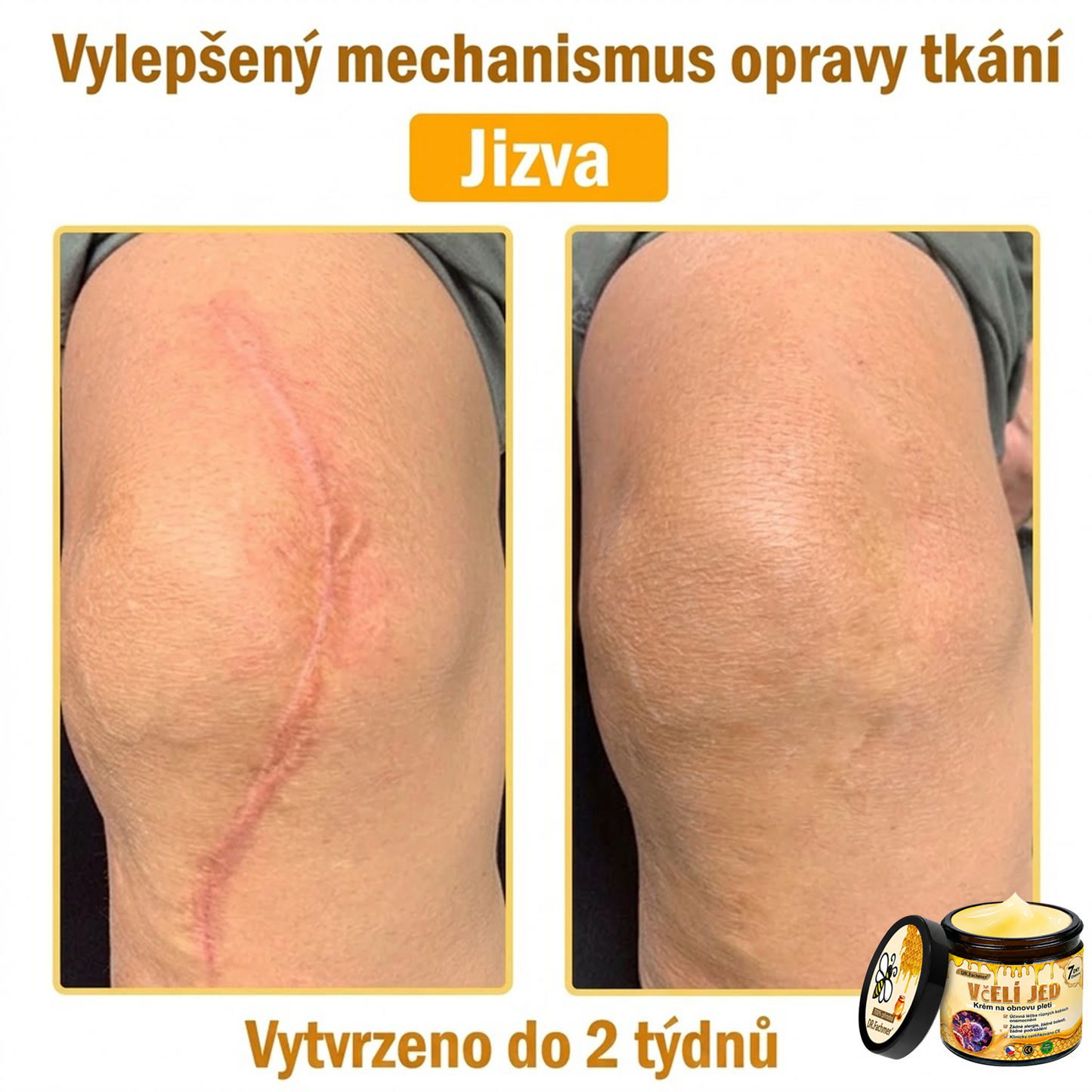⚡Dermatologicky a klinicky testováno👩‍⚕️DR.Fachmer®Bee Venom Krém na obnovení pleti🐝 pomáhá při léčbě kožních problémů, jako jsou: vrásky, jizvy, pigmentové skvrny, strie, akné, psoriáza, ekzém, kožní změny, podráždění, záněty a další kožní problémy.