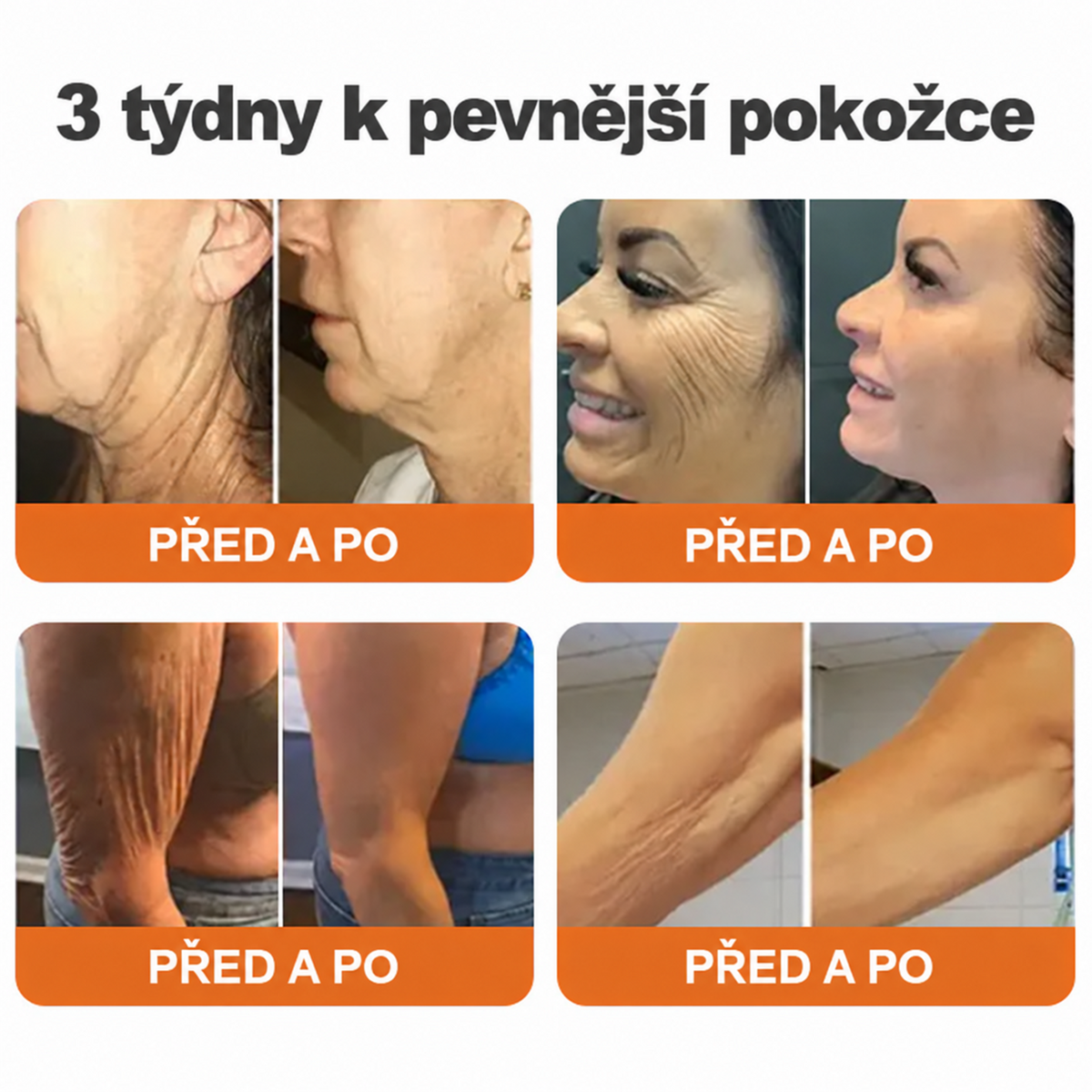 🌞Rolimey® Komplexní krém s včelím jedem Pro— Zpevňující péče pro všechny typy pokožky 🌞