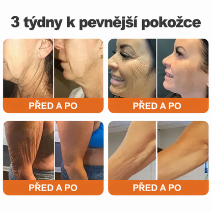 🌞Rolimey® Komplexní krém s včelím jedem Pro— Zpevňující péče pro všechny typy pokožky 🌞