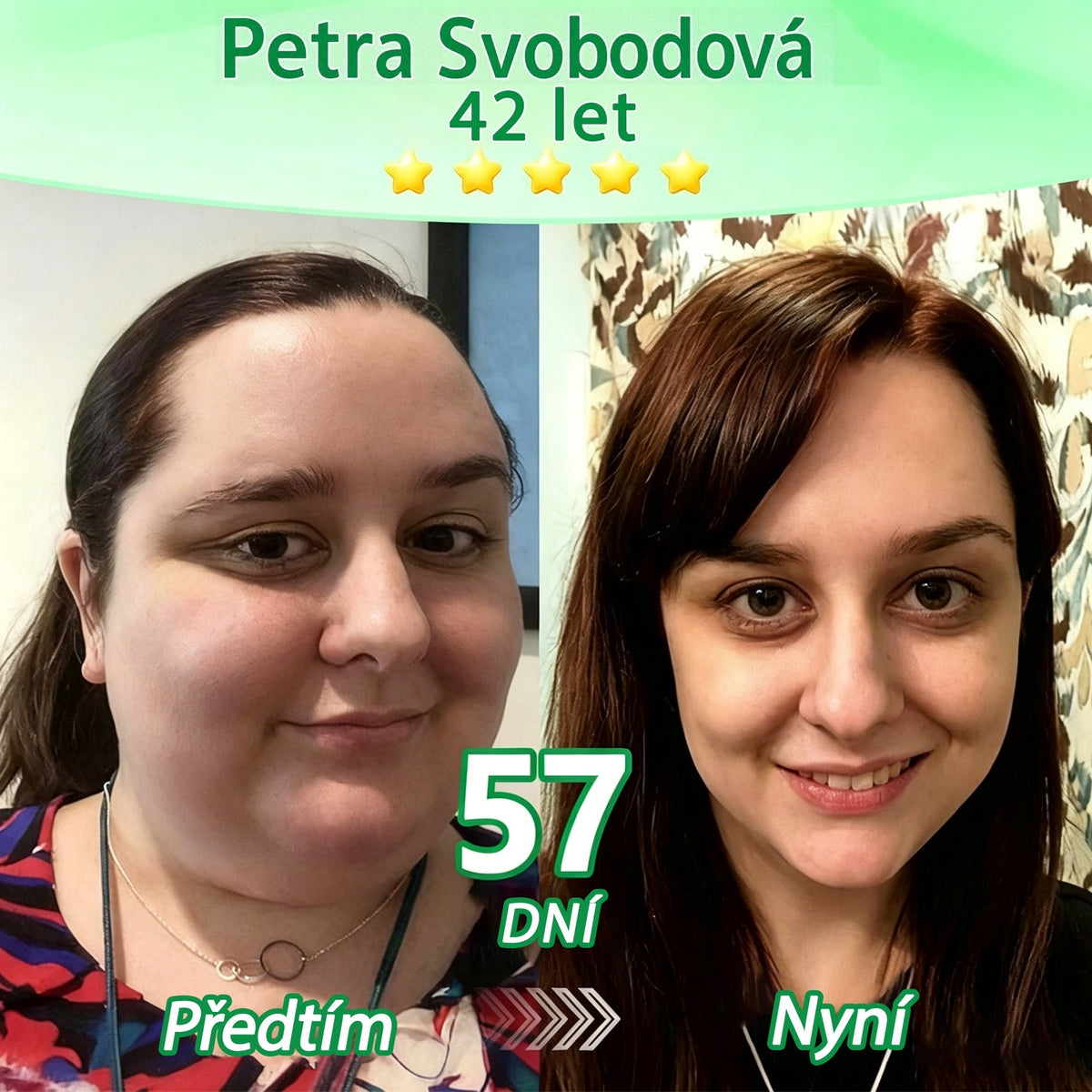 🏆 DR.Fachmer® Moringa + Berberin + NAD+ 15v1 nano-mikrojehličková náplast | Nová generace péče o tělo s pokročilou nano formulí ✨