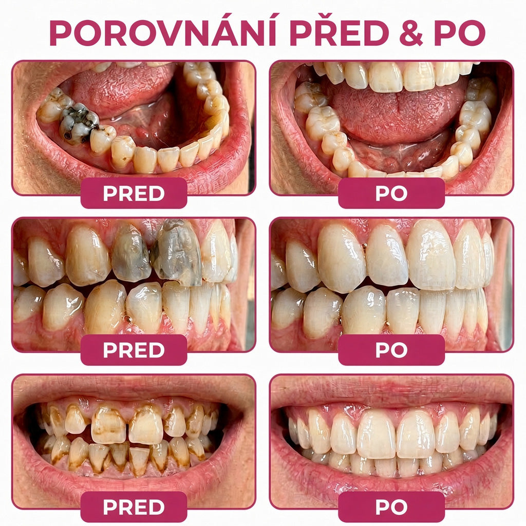 🏆𝐓𝐫𝐢𝐥𝐮𝐦𝐢𝐚® 𝐃𝐞𝐧𝐏𝐞𝐫𝐦🦷 – 𝐆𝐞𝐥 𝐧𝐚 𝐨𝐛𝐧𝐨𝐯𝐮 𝐳𝐮𝐛𝐧í𝐡𝐨 𝐤𝐚𝐳𝐮 𝐚 𝐩ř𝐢𝐫𝐨𝐳𝐞𝐧𝐨𝐮 𝐫𝐞𝐦𝐢𝐧𝐞𝐫𝐚𝐥𝐢𝐳𝐚𝐜𝐢 𝐳𝐮𝐛𝐧í 𝐬𝐤𝐥𝐨𝐯𝐢𝐧𝐲🥩