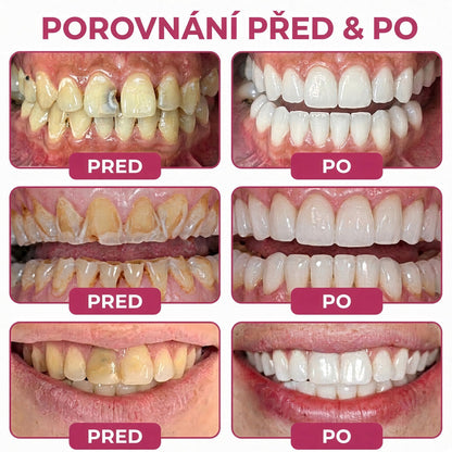 🏆𝐓𝐫𝐢𝐥𝐮𝐦𝐢𝐚® 𝐃𝐞𝐧𝐏𝐞𝐫𝐦🦷 – 𝐆𝐞𝐥 𝐧𝐚 𝐨𝐛𝐧𝐨𝐯𝐮 𝐳𝐮𝐛𝐧í𝐡𝐨 𝐤𝐚𝐳𝐮 𝐚 𝐩ř𝐢𝐫𝐨𝐳𝐞𝐧𝐨𝐮 𝐫𝐞𝐦𝐢𝐧𝐞𝐫𝐚𝐥𝐢𝐳𝐚𝐜𝐢 𝐳𝐮𝐛𝐧í 𝐬𝐤𝐥𝐨𝐯𝐢𝐧𝐲🥩