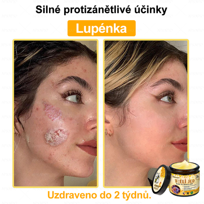 🐝🐝Dermatologicky a klinicky testováno👩‍⚕️DR.Fachmer®Bee Venom Krém na obnovení pleti🐝 pomáhá při léčbě kožních problémů, jako jsou: vrásky, jizvy, pigmentové skvrny, strie, akné, psoriáza, ekzém, kožní změny, podráždění, záněty a další kožní problémy.