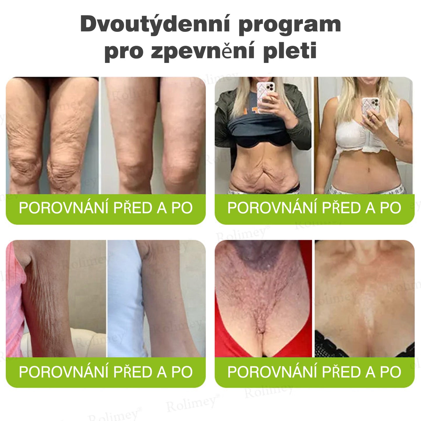 🔔Vyrobeno a odesláno z České republiky | Rolimey® Botox & Vita-A Retinol Shot Krém na vrásky a zpevnění pokožky – Poslední den akce 70% SLEVA
