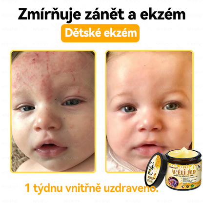 🐝🐝Dermatologicky a klinicky testováno👩‍⚕️DR.Fachmer®Bee Venom Krém na obnovení pleti🐝 pomáhá při léčbě kožních problémů, jako jsou: vrásky, jizvy, pigmentové skvrny, strie, akné, psoriáza, ekzém, kožní změny, podráždění, záněty a další kožní problémy.