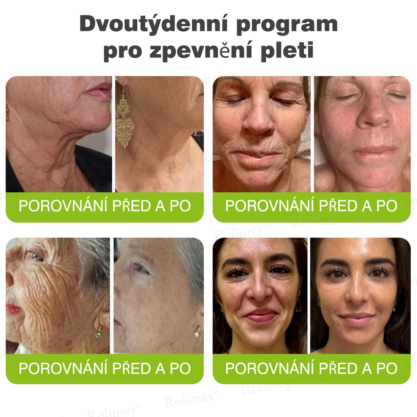 🔔Vyrobeno a odesláno z České republiky | Rolimey® Botox & Vita-A Retinol Shot Krém na vrásky a zpevnění pokožky – Poslední den akce 70% SLEVA