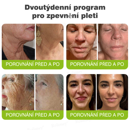 🔔Vyrobeno a odesláno z České republiky | Rolimey® Botox & Vita-A Retinol Shot Krém na vrásky a zpevnění pokožky – Poslední den akce 70% SLEVA