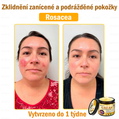 🐝🐝Dermatologicky a klinicky testováno👩‍⚕️DR.Fachmer®Bee Venom Krém na obnovení pleti🐝 pomáhá při léčbě kožních problémů, jako jsou: vrásky, jizvy, pigmentové skvrny, strie, akné, psoriáza, ekzém, kožní změny, podráždění, záněty a další kožní problémy.