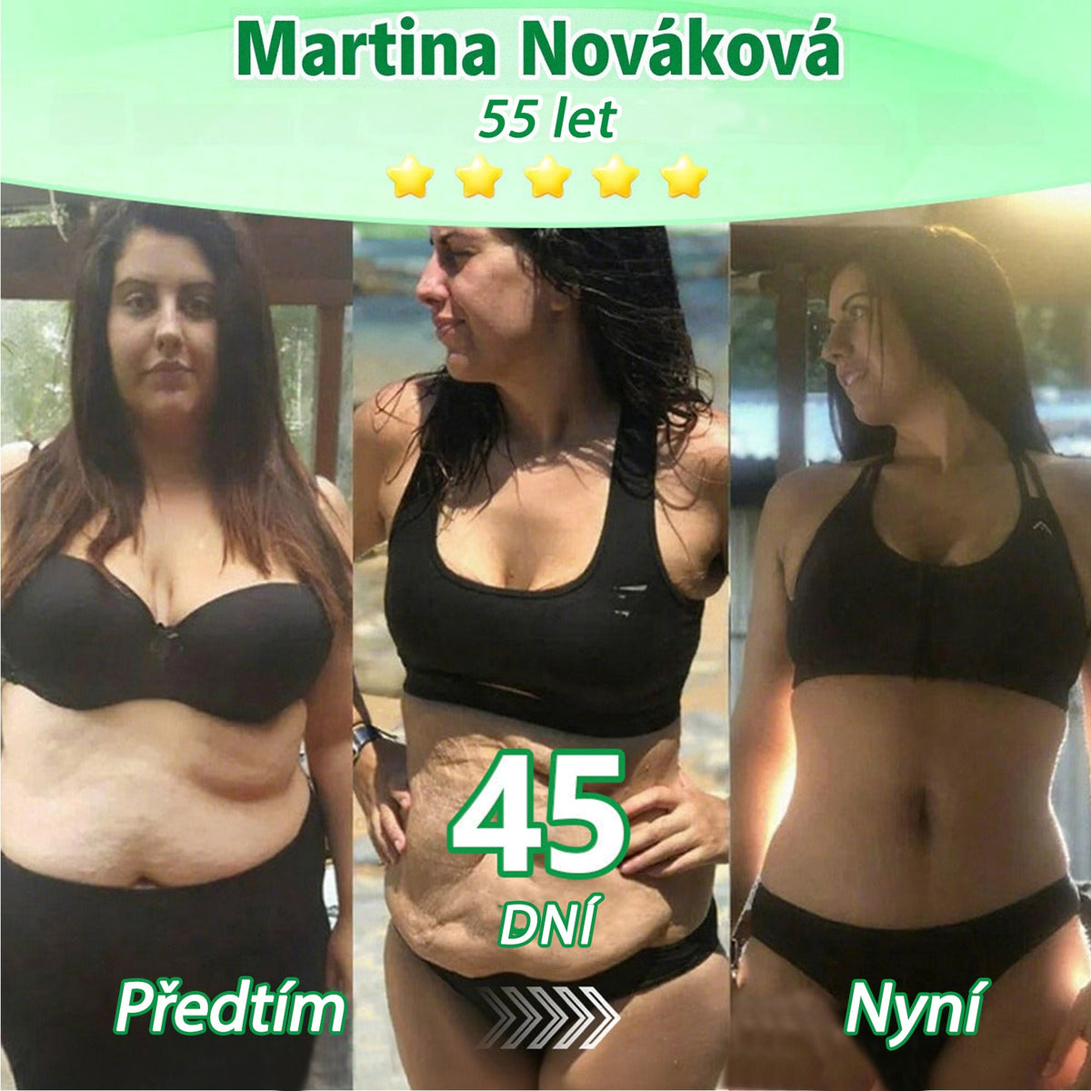 🏆 DR.Fachmer® Moringa + Berberin + NAD+ 15v1 nano-mikrojehličková náplast | Nová generace péče o tělo s pokročilou nano formulí ✨