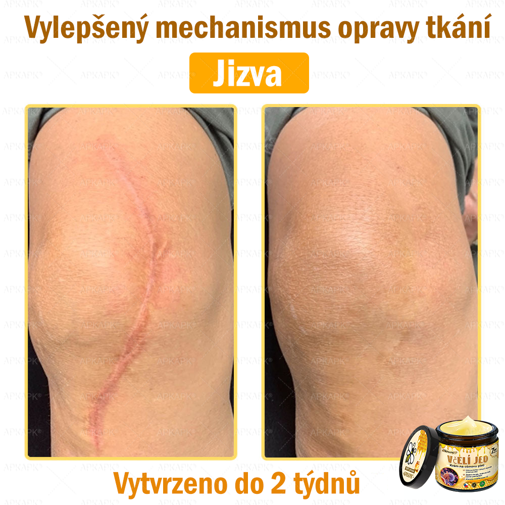🐝🐝Dermatologicky a klinicky testováno👩‍⚕️DR.Fachmer®Bee Venom Krém na obnovení pleti🐝 pomáhá při léčbě kožních problémů, jako jsou: vrásky, jizvy, pigmentové skvrny, strie, akné, psoriáza, ekzém, kožní změny, podráždění, záněty a další kožní problémy.