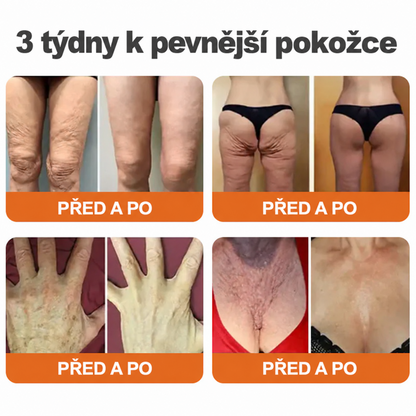 🌞Rolimey® Komplexní krém s včelím jedem Pro— Zpevňující péče pro všechny typy pokožky 🌞