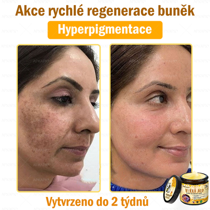🐝🐝Dermatologicky a klinicky testováno👩‍⚕️DR.Fachmer®Bee Venom Krém na obnovení pleti🐝 pomáhá při léčbě kožních problémů, jako jsou: vrásky, jizvy, pigmentové skvrny, strie, akné, psoriáza, ekzém, kožní změny, podráždění, záněty a další kožní problémy.